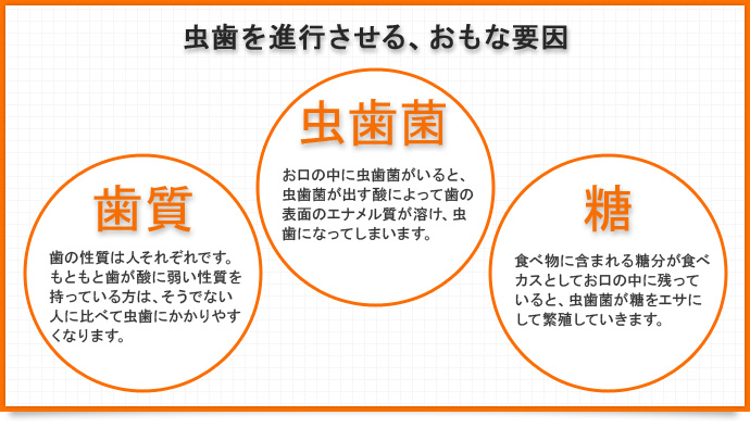 虫歯を進行させる、おもな要因