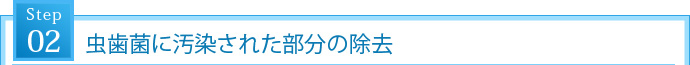 STEP2. 虫歯菌に汚染された部分の除去